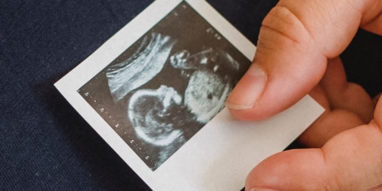 LDO: Lula veta proibição de gastos com aborto e mudança de sexo